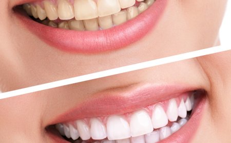 10 Amazing Foods That Naturally Help Whiten Your Teeth 🦷✨